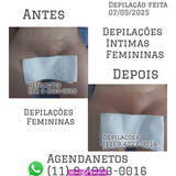 Luiz depilacoes intimas para mulheres 11 9 4023 0016 zon